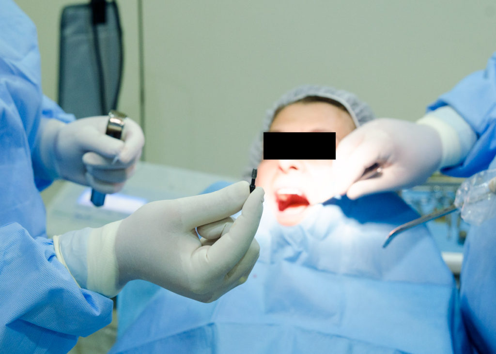 Surgical treatments