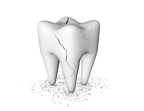 cracked tooth